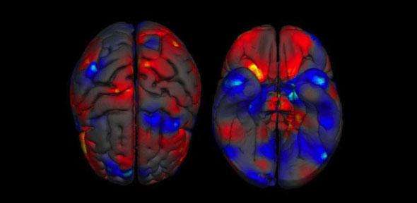 Images du cerveau montrant la différence de volume de la matière grise entre les hommes et les femmes. Les régions où la substance grise est plus volumineuse sont en rouge pour la femme et en bleu pour l’homme. © Neuroscience and Biobehavioral Reviews, cc by nc sa 3.0