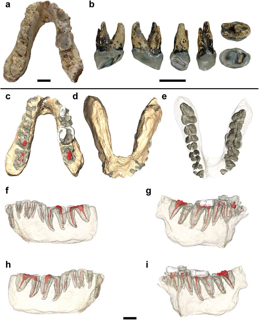 En haut, la mandibule de Graecopithecus freybergi trouvée à Pyrgos, en Grèce et, à gauche, la dent découverte à Azmaka, en Bulgarie, et appartenant à un animal appartenant au même genre, Graecopithecus sp., si ce n'est à la même espèce. De c à e, différentes vues de la mandibule et, de f à i, les images construites au scanner CT, montrant l'implantation des dents. Les barres d'échelle représentent toutes 1 cm. © Jochen Fuss et al., Plos One