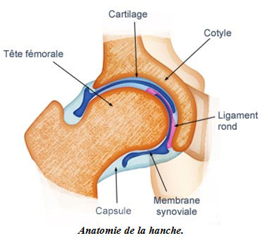 comment soigner arthrose de la hanche