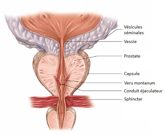 外形如栗子的攝護腺所分泌的攝護腺液，可形成精液，當攝護腺發炎，就可能精液帶血。
