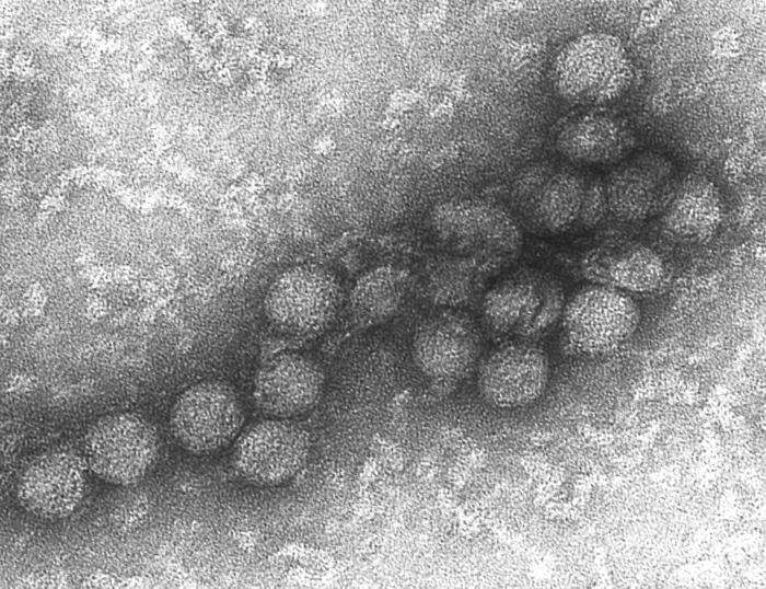 Définition | Virus du Nil occidental - West Nile virus ...