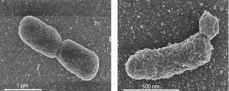 Des irrégularités sont observées au niveau de la membrane cellulaire des bactéries génétiquement modifiées (à droite), lorsque la production de lipides archéens est trop importante. À titre de comparaison, la membrane des bactéries E. coli normales (à gauche) est lisse. Les images sont obtenues au microscope électronique à balayage. © University of Wageningen/Van der Oost Laboratory