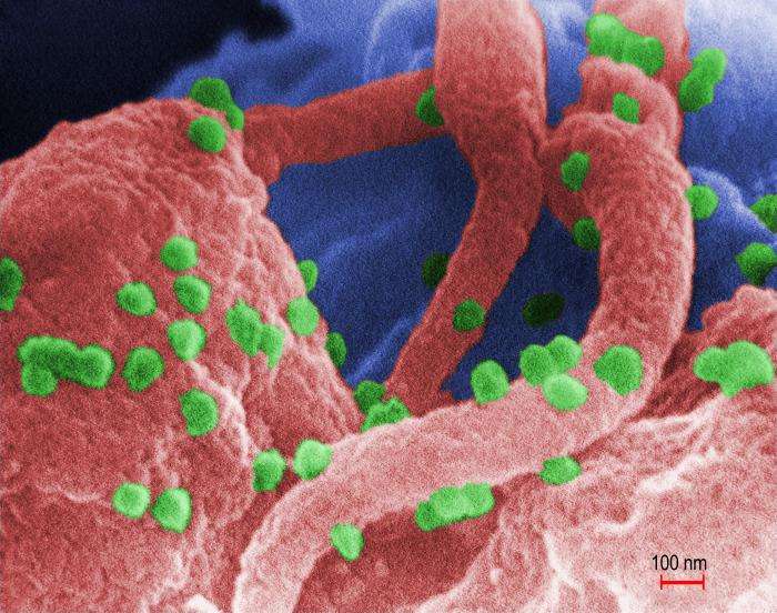 VIH : le virus du Sida et ses 30 millions de victimes