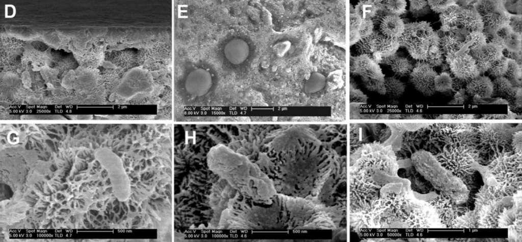 Dans les échantillons rapportés par les chercheurs, des colonies d’organismes vingt fois plus petits que les bactéries moyennes, ici vues au microscope électronique à balayage. © Centro de Astrobiologia