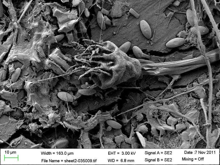 Une ciliée Suctoria couverte de bactéries symbiotiques et des diatomées, fixées sur un morceau de plastique fissuré et altéré. © Erik Zettler, Sea Education Association
