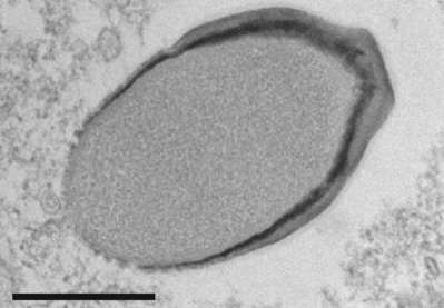 Virus P. quercus observé au microscope électronique. La barre représente 500 nm. © Legendre et al., Nature Communications 2018