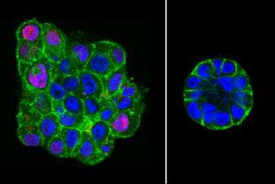 Ces images en fluorescence montrent la différence de structure entre les cellules malignes non comprimées (à gauche) et celles comprimées (à droite), ces dernières prennent une forme bien plus proche d'un acinus sain. © Avec l'aimable autorisation de Daniel Fletcher, université de Californie à Berkeley