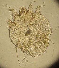 Le sarcopte (Sarcoptes scabiei) est un des nombreux parasites qui pondent sous la peau. © Kalumet, Wikipédia