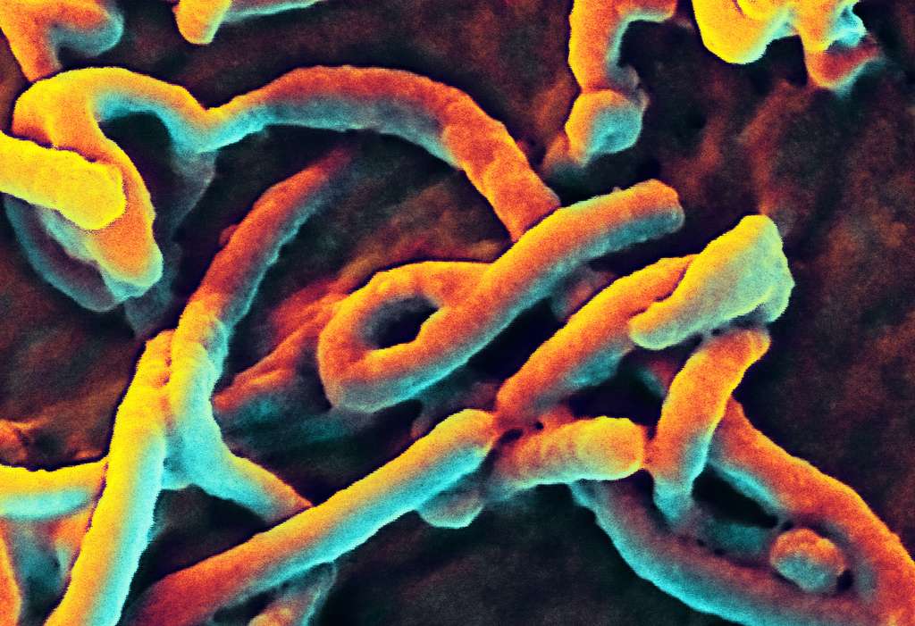 Le virus Ebola ou d'autres maladies encore inconnues sont susceptibles de déclencher une pandémie. © Niaid