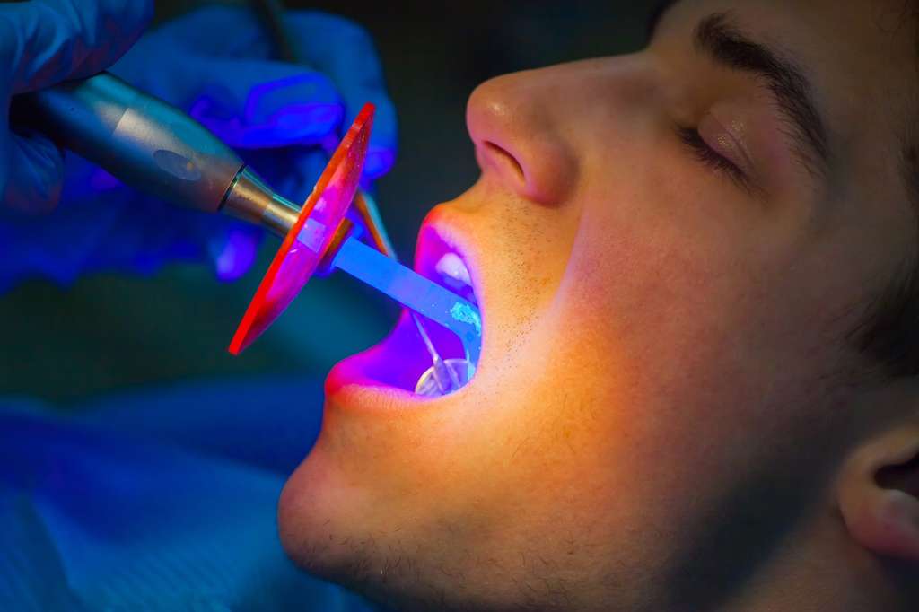 La lumière ultraviolette est aussi utilisée dans le cabinet du dentiste. © satyrenko, Fotolia